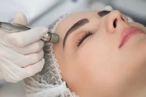 best treatment for melasma on face